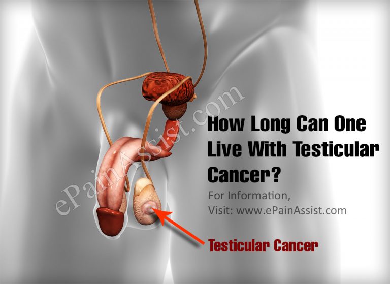 How Long Can One Live With Testicular Cancer?