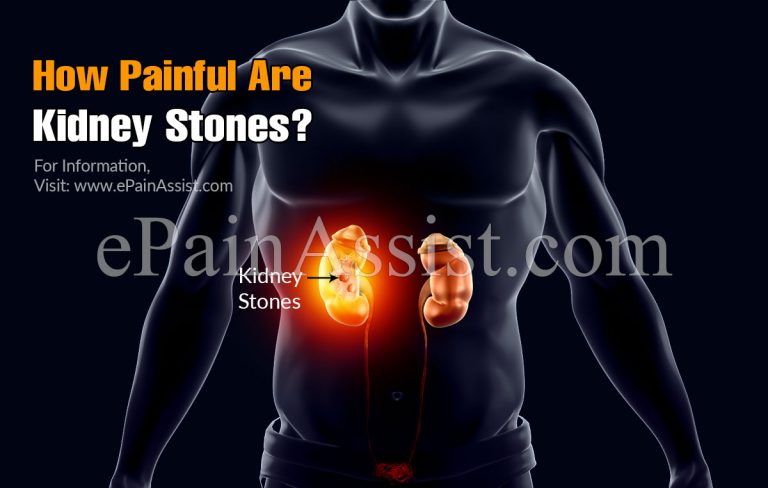 How Painful Are Kidney Stones?