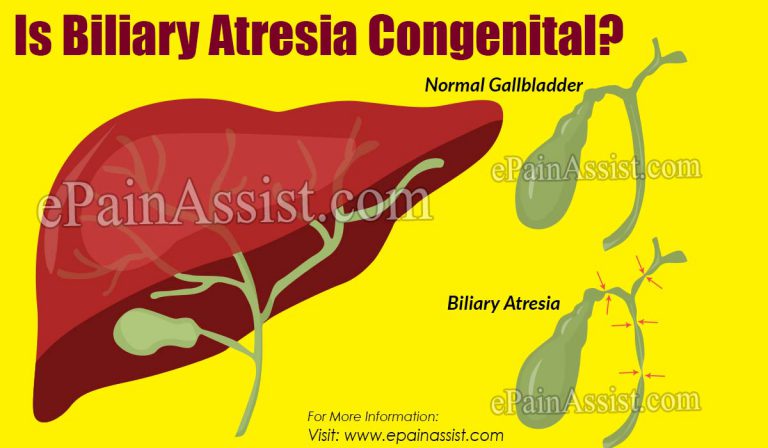 Is Biliary Atresia Congenital?