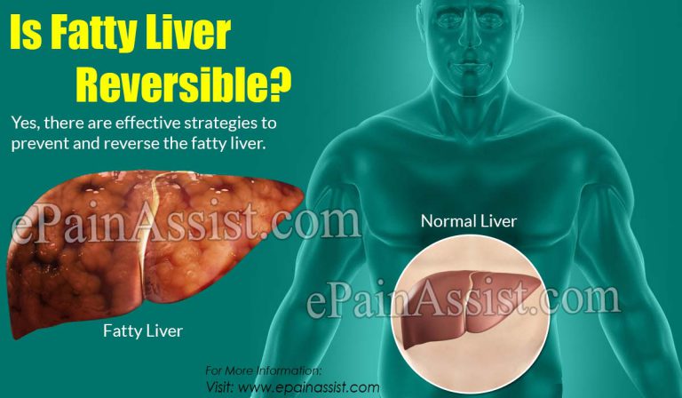 Is Fatty Liver Reversible?
