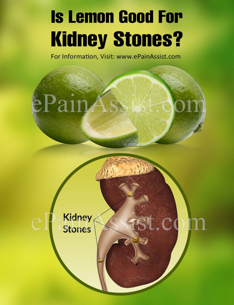 Is Lemon Good For Kidney Stones?