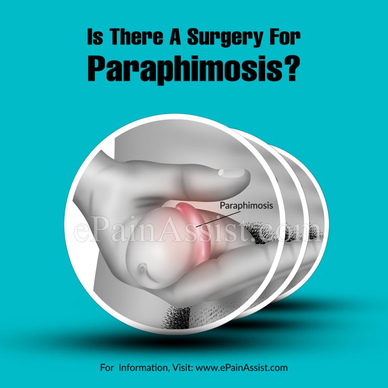 Is There A Surgery For Paraphimosis?
