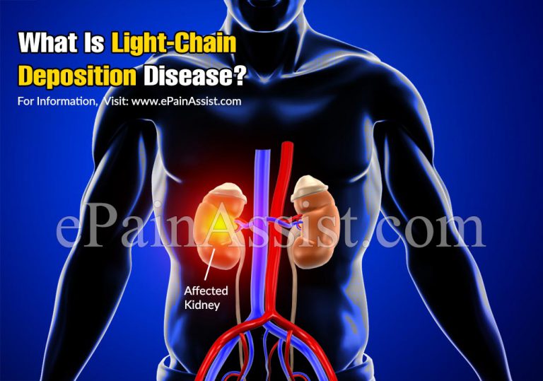 Light Chain Deposition Disease: Causes, Symptoms, Treatment, Survival Rate