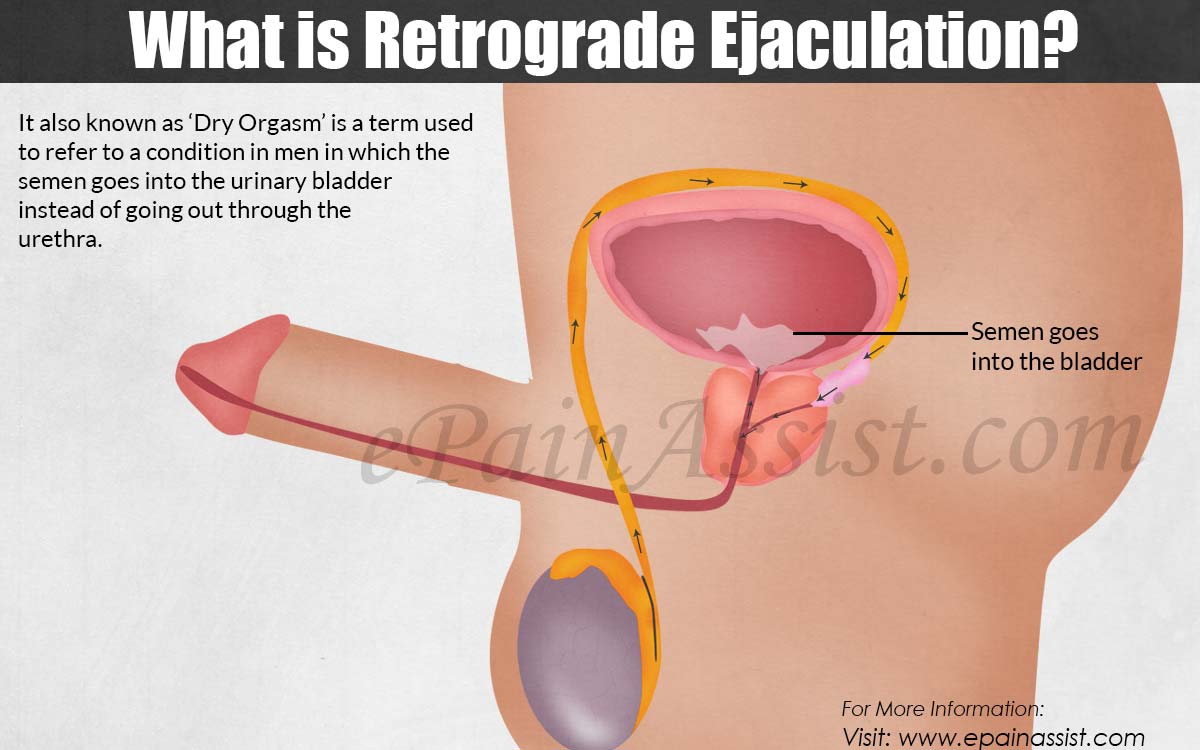 Anal pain after ejaculation