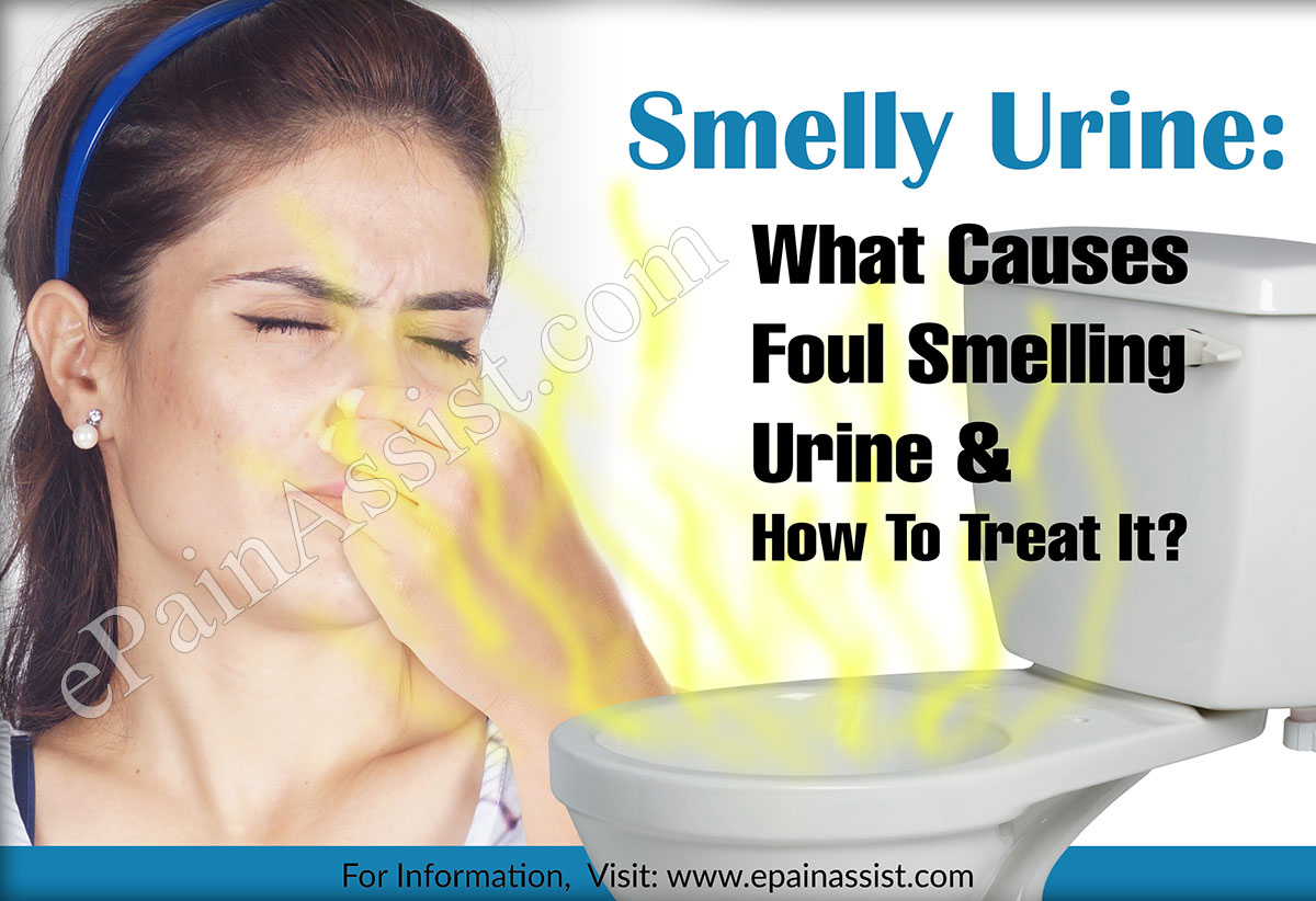 Smelly Urine: What Causes Foul Smelling Urine & How To Treat It?