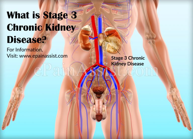 Signs of Stage 3 Chronic Kidney Disease & How Can Diet Help With Stage 3 Chronic Kidney Disease?
