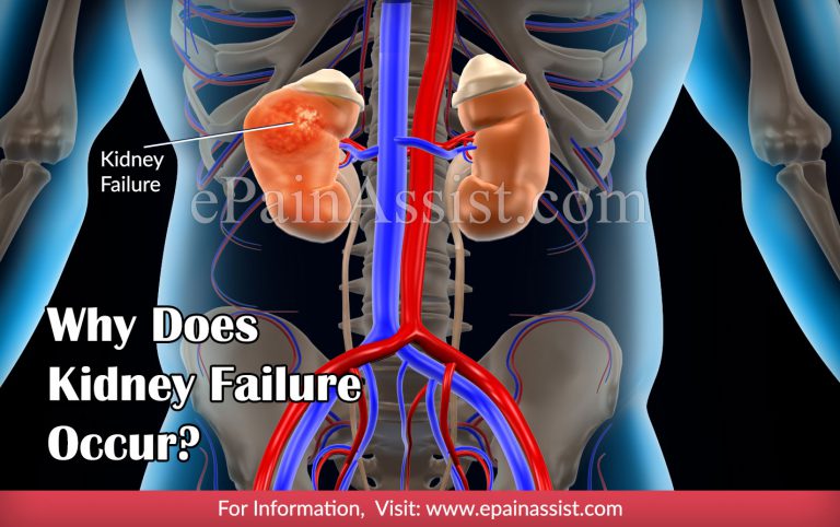 Symptoms of Kidney Failure & Why Does Kidney Failure Occur?
