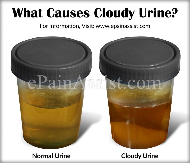 What Causes Cloudy Urine & 12 Home Remedies To Get Rid of It
