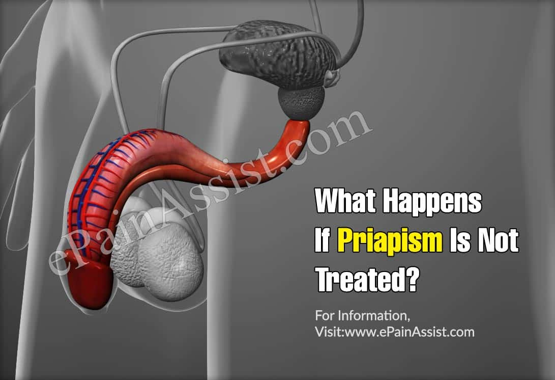 What Happens If Priapism Is Not Treated?