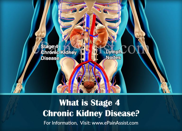 What is Stage 4 Chronic Kidney Disease?