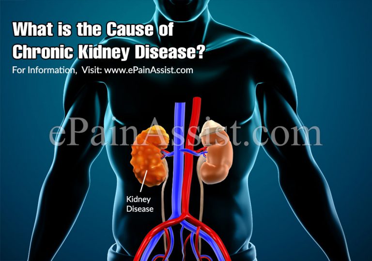 What is the Cause of Chronic Kidney Disease or CKD?