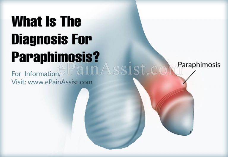 What Is The Diagnosis For Paraphimosis?