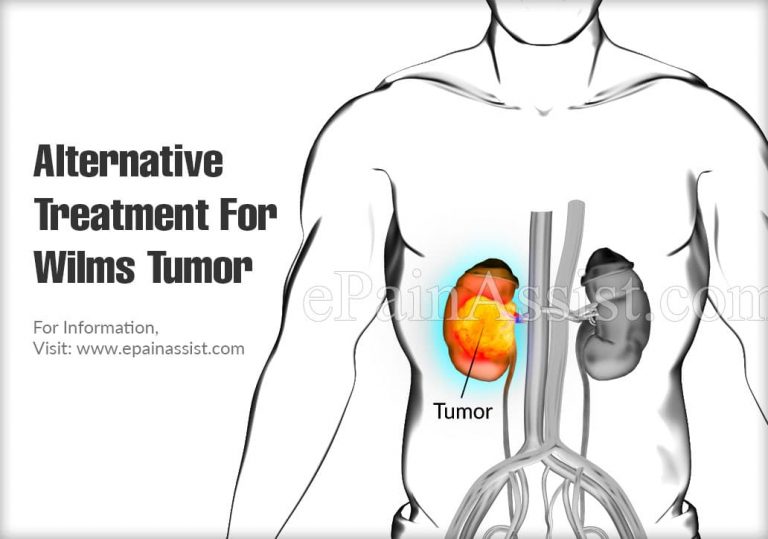 Alternative Treatment For Wilms Tumor & Is It A Progressive Disease?