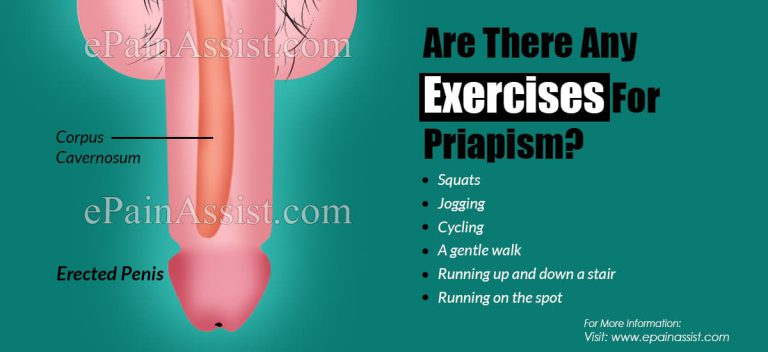 Are There Any Exercises For Priapism?