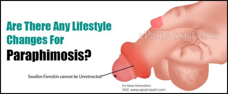 Are There Any Lifestyle Changes For Paraphimosis?