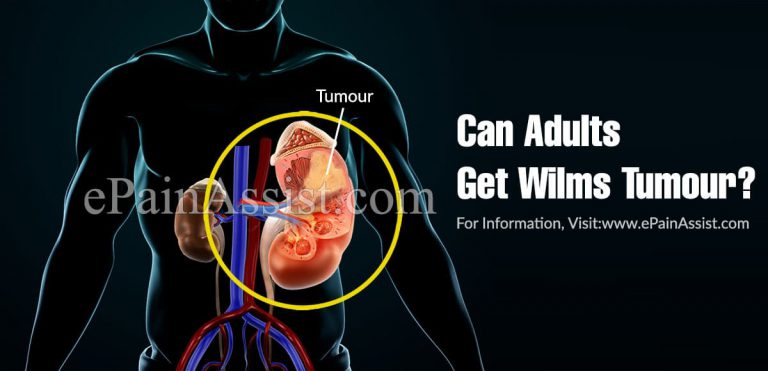 Can Adults Get Wilms Tumour And What Are Its Symptoms In Adults?