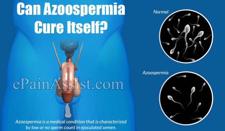 Can Azoospermia Cure Itself?