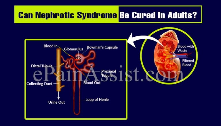 Can Nephrotic Syndrome Be Cured In Adults?