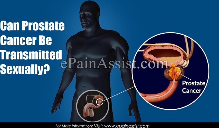 Can Prostate Cancer Be Transmitted Sexually?