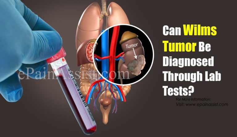 Can Wilms Tumor Be Diagnosed Through Lab Tests & What Are The Types Of Treatment?