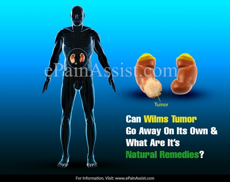 Can Wilms Tumor Go Away On Its Own & What Are It’s Natural Remedies?