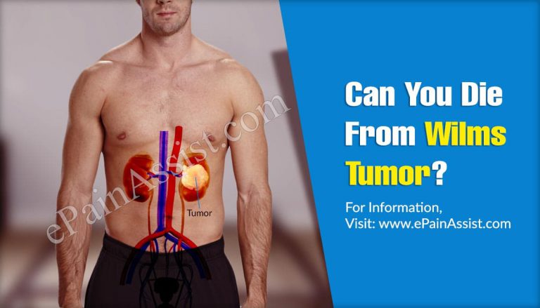 Can You Die From Wilms Tumor & Can It Spread?
