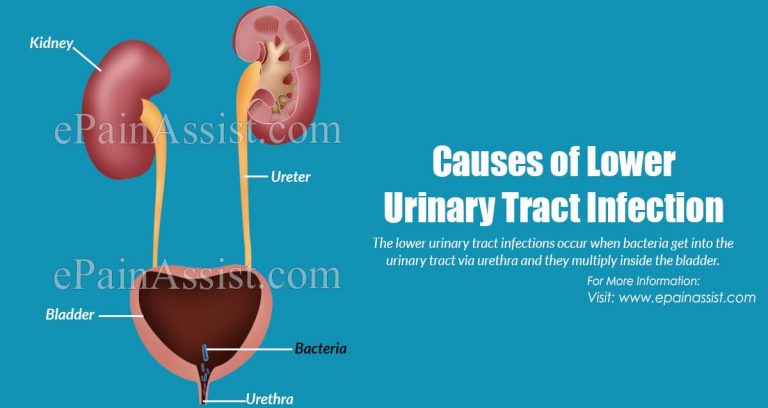 What is Lower Urinary Tract Infection & How is it Treated?| Causes, Symptoms, Complications of Lower Urinary Tract Infection