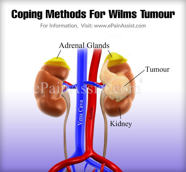 Coping Methods For Wilms Tumour
