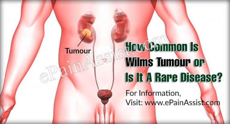 How Common Is Wilms Tumour Or Is It A Rare Disease?