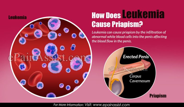 How Does Leukemia Cause Priapism?