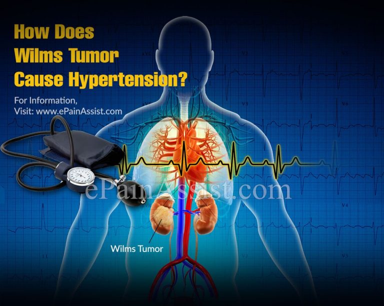 How Does Wilms Tumor Causes Hypertension?