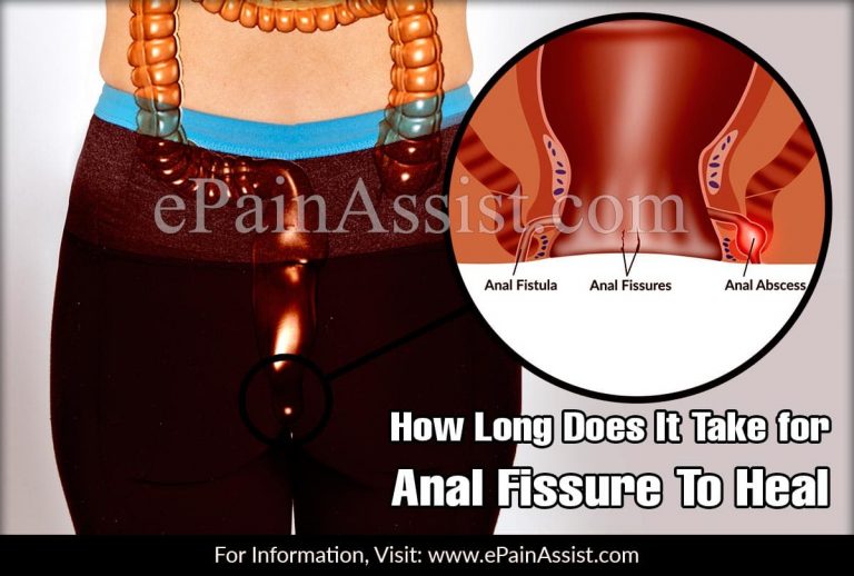 How Long Does It Take for Anal Fissure To Heal & What Are The Remedies To Soothe Its Symptoms?