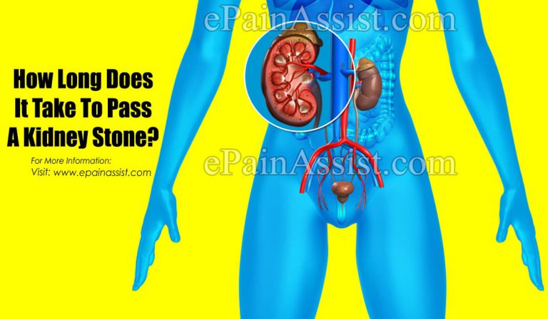 How Long Does It Take To Pass A Kidney Stone?