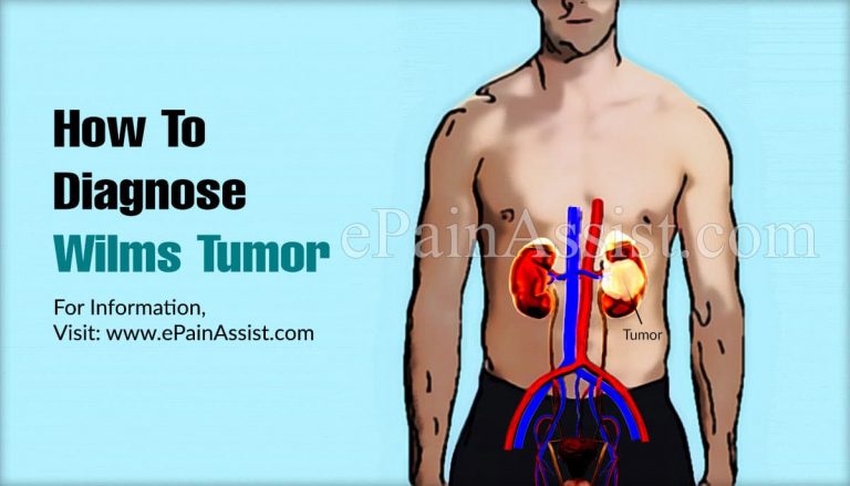 How To Diagnose Wilms Tumor & What Is The Best Medicine For It?