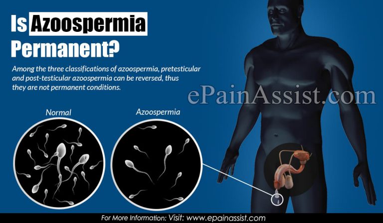 Is Azoospermia Permanent?