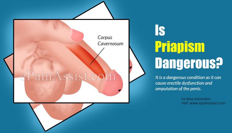 Is Priapism Dangerous?