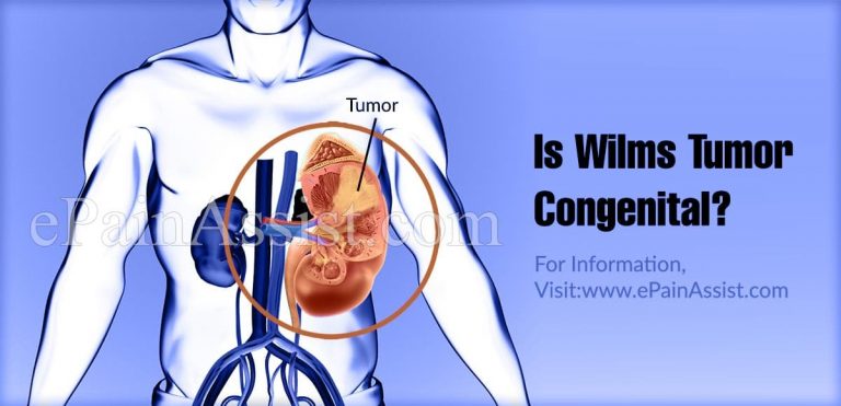 Is Wilms Tumor Congenital?