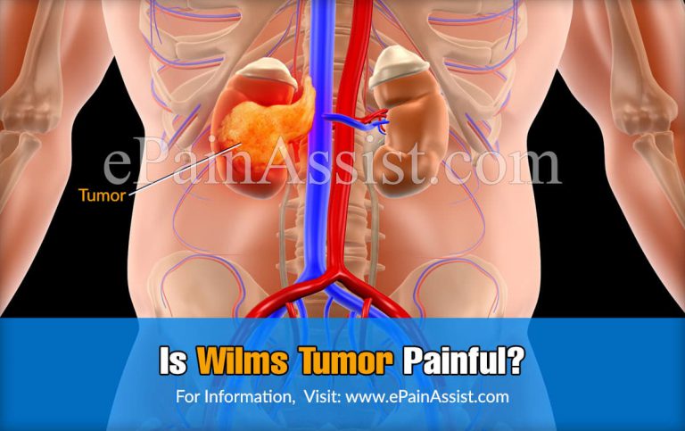 Is Wilms Tumor Painful & Is It Genetic?