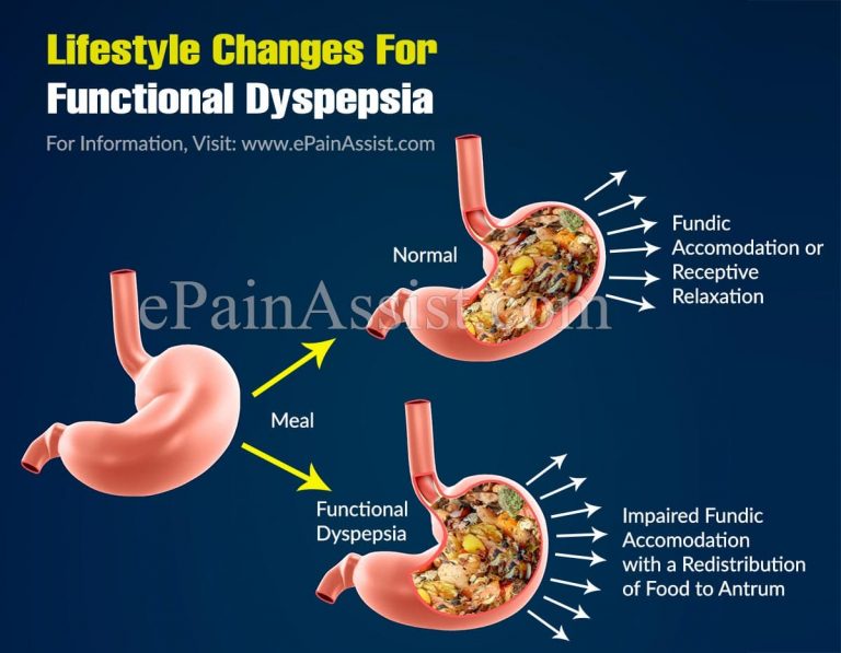 Lifestyle Changes For Functional Dyspepsia