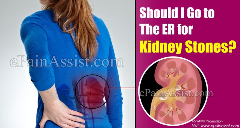 Should I Go To The ER For Kidney Stones?