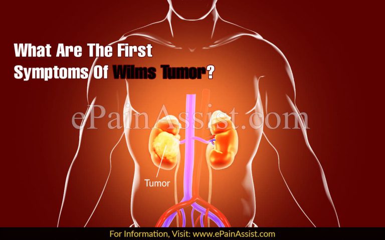 What Are The First Symptoms Of Wilms Tumor & How Do You Test For It?