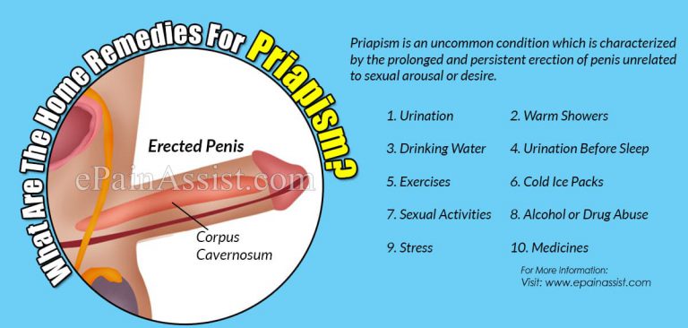 What Are The Home Remedies For Priapism?