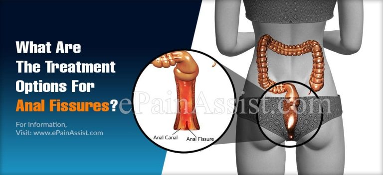 What Are The Treatment Options For Anal Fissures?