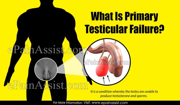 What Is Primary Testicular Failure?