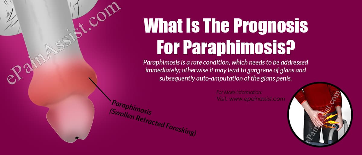 What Is The Prognosis For Paraphimosis?