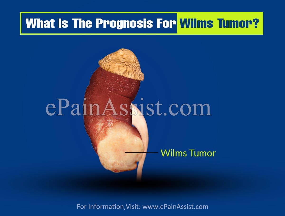 What Is The Prognosis For Wilms Tumor?