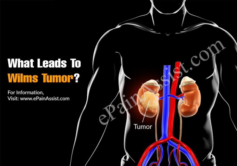 What Leads To Wilms Tumor & Can It Be Cured?