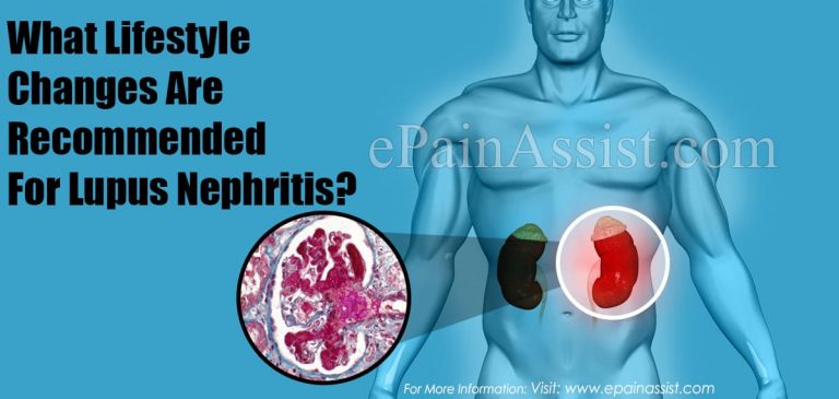 What Lifestyle Changes Are Recommended For Lupus Nephritis?