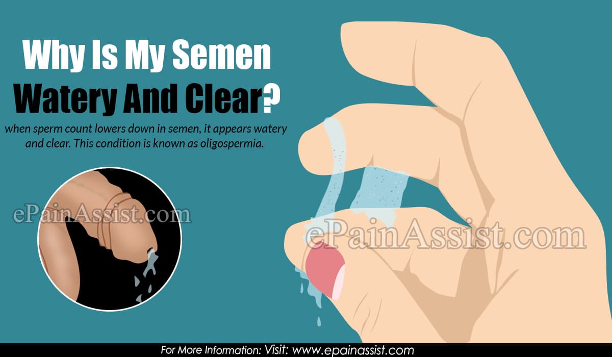 Why is my cum so watery 3 Why Is My Semen Watery And Clear?