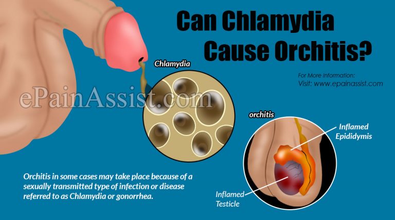 Can Chlamydia Cause Orchitis & Can Orchitis Cause Low Testosterone?